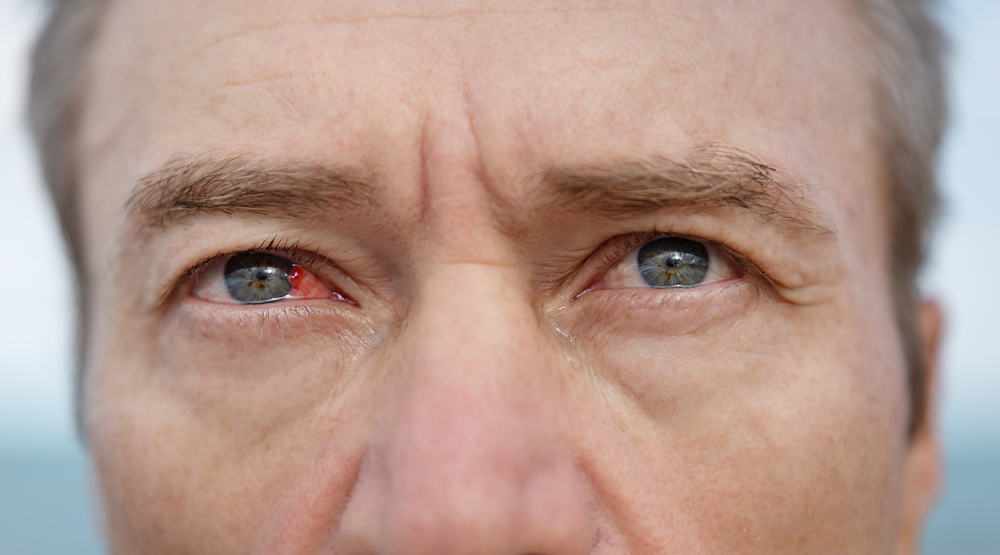 Common Types of Ocular Disease: Symptoms, Causes, and Treatment Options