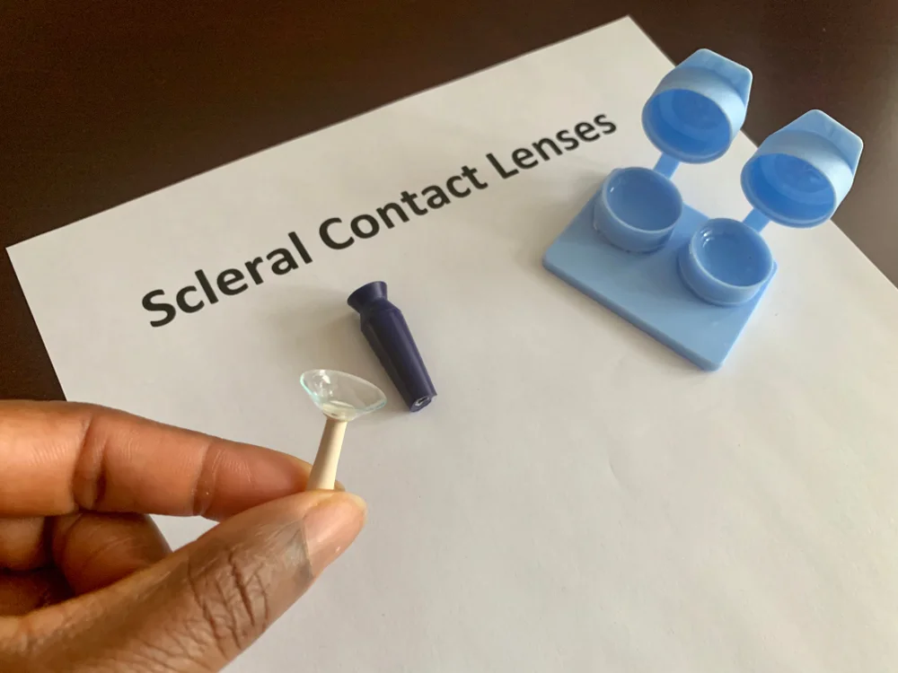 Scleral Lenses for Hard-to-Fit Eyes: Advanced Solutions in the West Shore Area