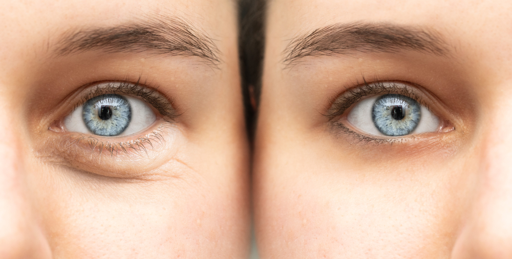 Ocular Aesthetics