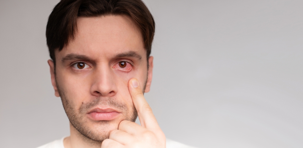 TearCare: Understanding Dry Eye and Its Causes