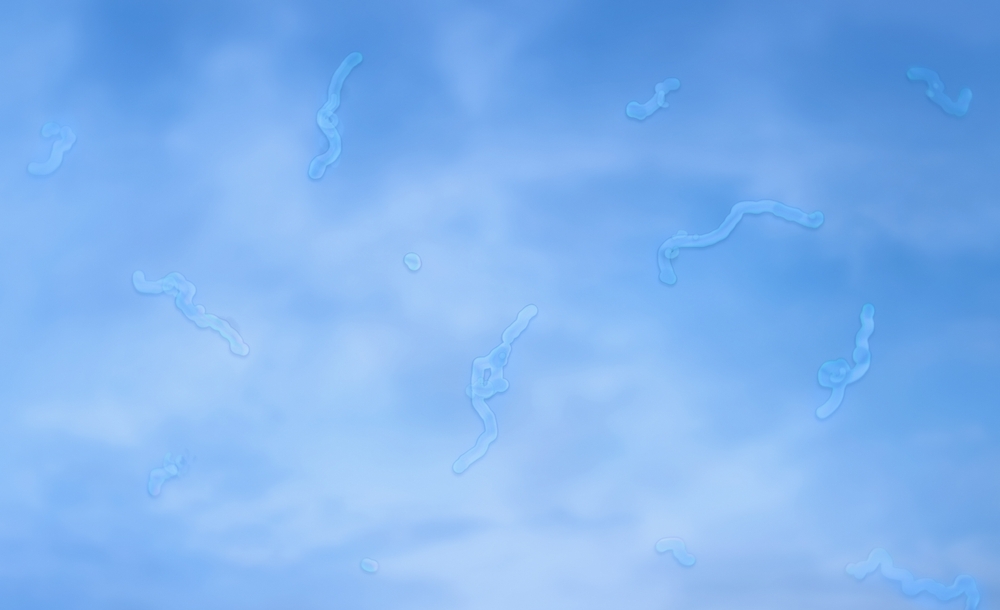 Understanding Eye Floaters: What They Are and When You Should Be Concerned